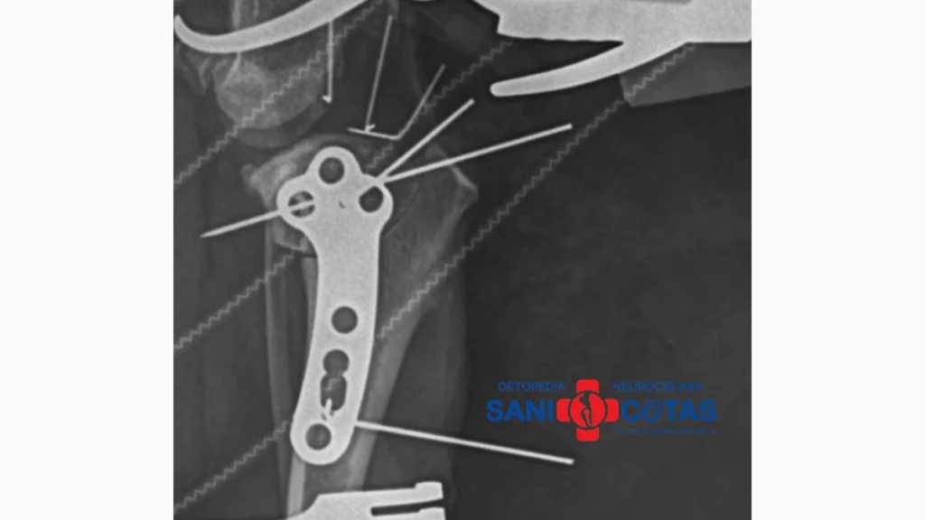 Radiografía ortopédica veterinaria utilizada para el diagnóstico de lesiones óseas en SaniMascotas Popayán.